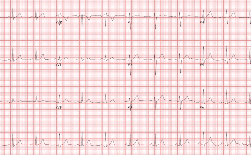 Portable ECG - Portable Xray Centre